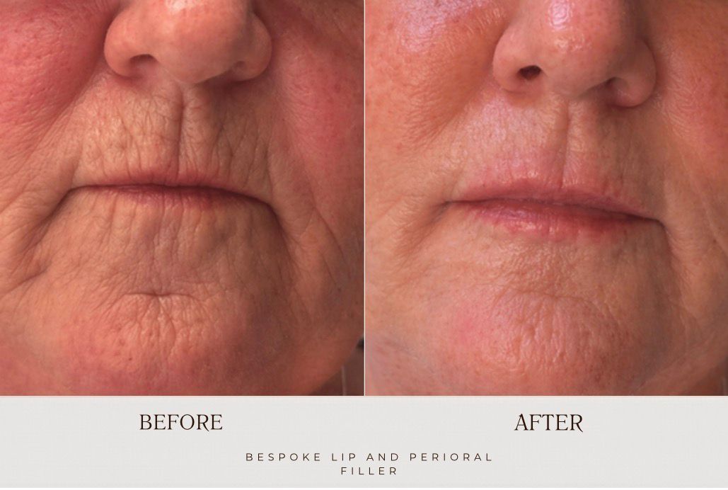 Before and after comparison